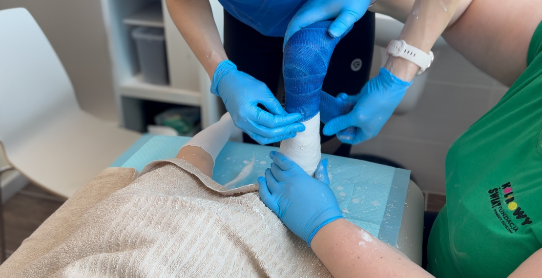 Turnus gipsowania w Kolorowym Świecie