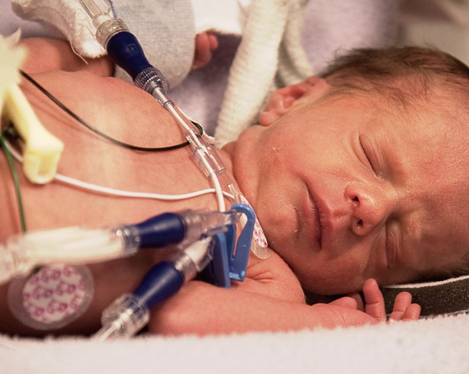 Mała dłoń wcześniaka z plasterkiem, zaciskająca się na palcu dorosłego – symbol walki o życie, którą wspiera Twoje 1,5% podatku.